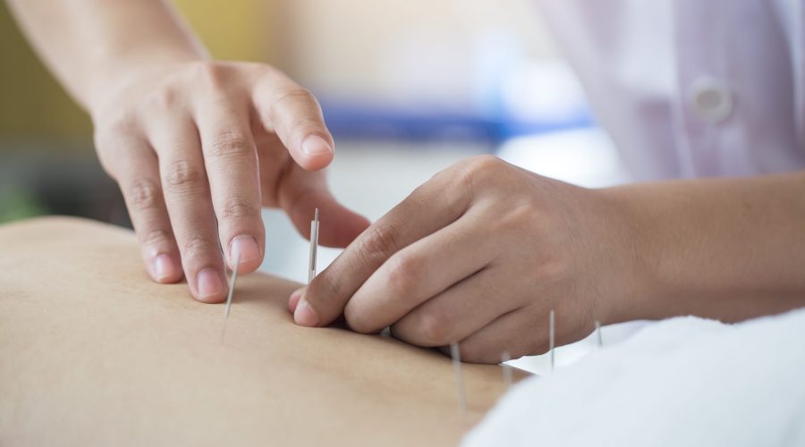 Acupuncture Treatment For Pain Relief: Yvonne’s Experience