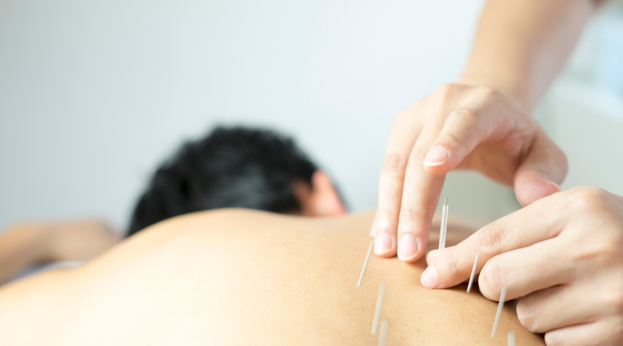 9 tips on how to choose an acupuncturist