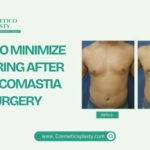 How to minimise scarring after gynecomastia surgery